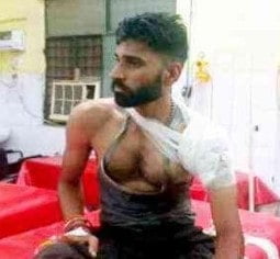 कमरे में सोने को लेकर हुए विवाद में युवक को मारी गोली, हालत गंभीर, आरोपी मौसा फरार