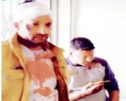 ४० हजार रुपए आरोपियों से मांगना बहुत महंगा पड़ गया, की मारपीट 4 3 News 8 |