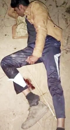 बुआड़ा फाटक के समीप मुठभेड में बाईक सवार बदमाश घायल