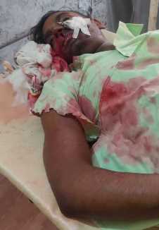 शाहपुर में भीषण सडक हादसे में फल विक्रेता की मौत, दो गम्भीर घायल