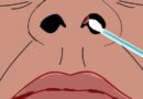 Nose |
