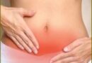 रसौली/गांठ (Fibroid) के कारण, लक्षण और आयुर्वेद उपचार