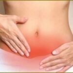 रसौली/गांठ (Fibroid) के कारण, लक्षण और आयुर्वेद उपचार