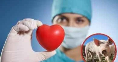 Heart-Transplant_