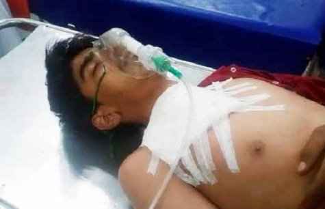 Muzaffarnagar News: दूसरे समुदाय के युवक को मारी गोली, गांव में भारी पुलिस फोर्स तैनात