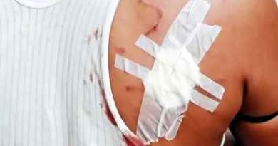 Muzaffarnagar News: बुढाना में बंदरों का आतंक, छुटकारा दिलाने की मांग