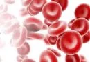 Anemia