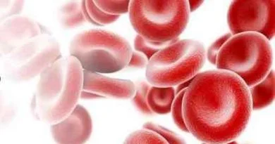 Anemia