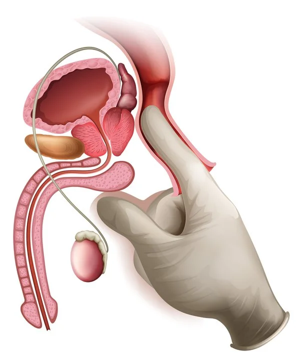 Prostatitis