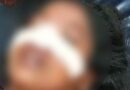Shahjahanpur: पीड़िता ने केस वापस नहीं लिया तो बीच सड़क पर दरांती से काट दी नाक