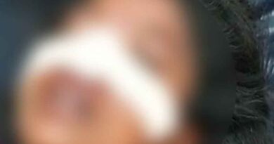 Shahjahanpur: पीड़िता ने केस वापस नहीं लिया तो बीच सड़क पर दरांती से काट दी नाक