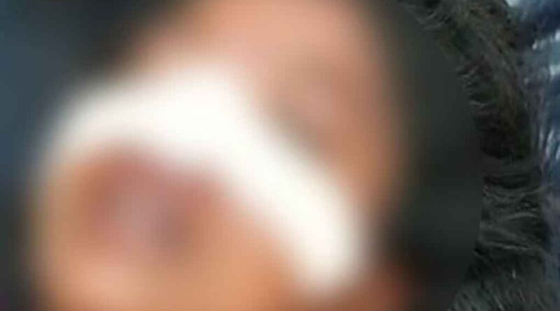 Shahjahanpur: पीड़िता ने केस वापस नहीं लिया तो बीच सड़क पर दरांती से काट दी नाक