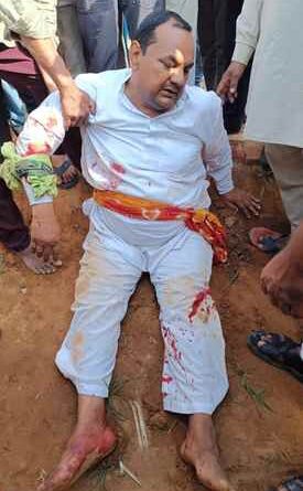 Muzaffarnagar News- व्यापारी को बदमाशों ने गोली मारकर किया घायल