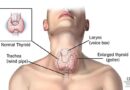साइलेंट बीमारियों का घर है Thyroid: हल्के में लेना बड़ा सकता है मुसीबत, जानें लक्षण?