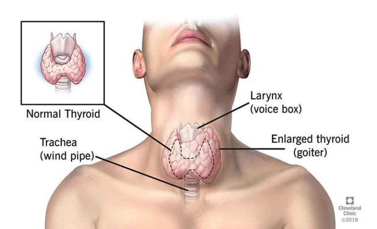 साइलेंट बीमारियों का घर है Thyroid: हल्के में लेना बड़ा सकता है मुसीबत, जानें लक्षण?