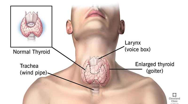 साइलेंट बीमारियों का घर है Thyroid: हल्के में लेना बड़ा सकता है मुसीबत, जानें लक्षण?