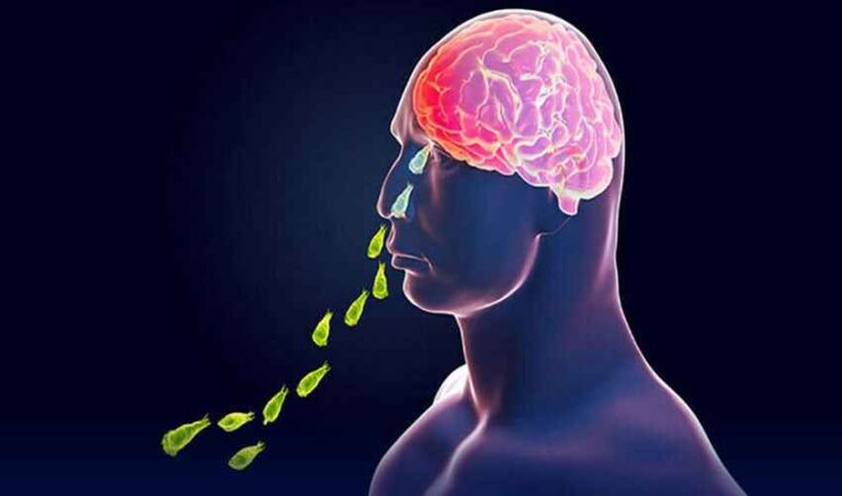 Brain-Eating Amoeba: पाकिस्तानी व्यक्ति की मौत