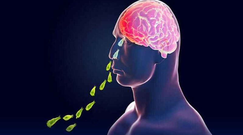 Brain-Eating Amoeba: पाकिस्तानी व्यक्ति की मौत