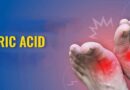 यूरिक एसिड (Uric Acid) बढ़ने का कारण, लक्षण: अचूक घरेलू उपाय?