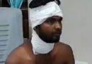 Hardoi News- बर्गर के पैसे मांगने पर हिस्ट्रीशीटर का खूनी हमला: दबंगई की नई मिसाल