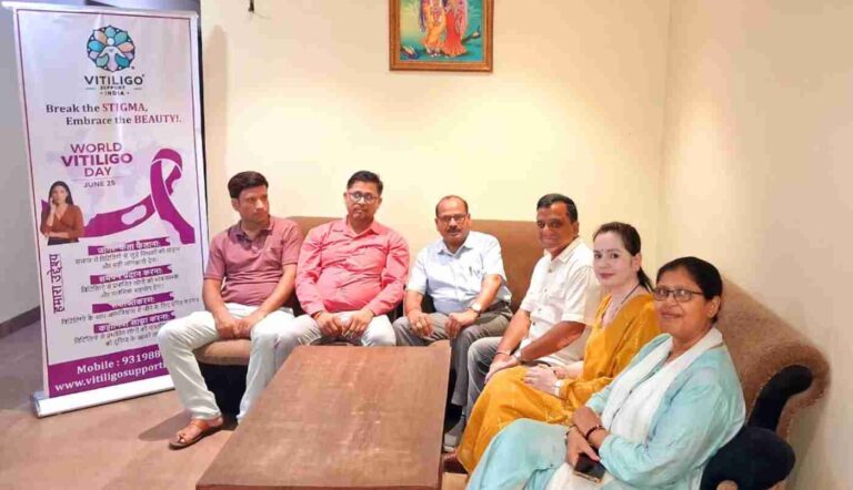 World Vitiligo Day पर Mathura से उठी समाज को चेताने वाली आवाज़- सफेद दाग कोई अभिशाप नहीं, एक पहचान?