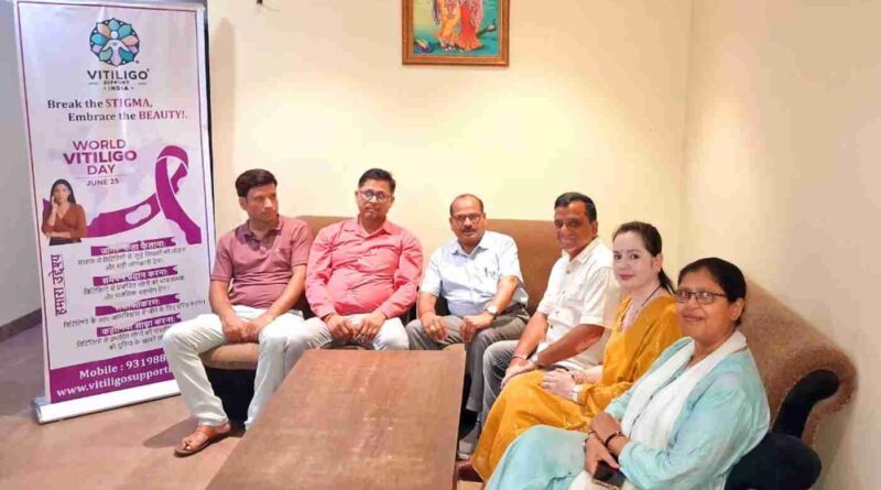 World Vitiligo Day पर Mathura से उठी समाज को चेताने वाली आवाज़- सफेद दाग कोई अभिशाप नहीं, एक पहचान?