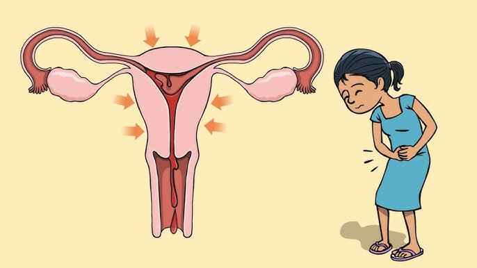 Major problems related to menstruation-menstrual related problems