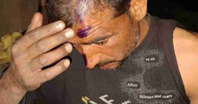 Muzaffarnagar शुक्रताल खादर में खौफनाक हमला: दो दर्जन से अधिक हमलावरों ने खेतों में काम कर रहे मजदूरों को पीटा, कई गंभीर घायल