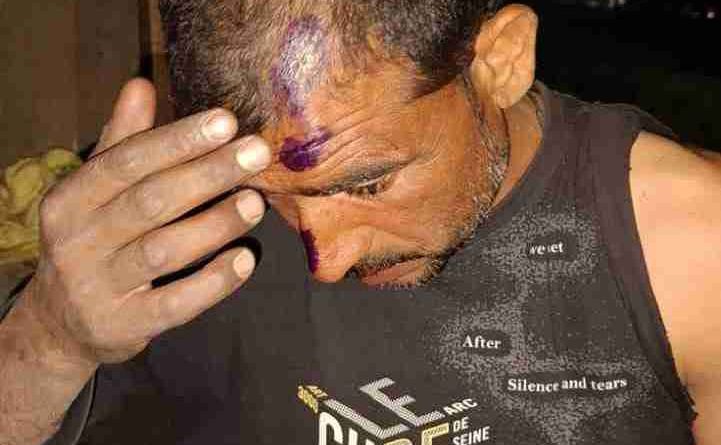 Muzaffarnagar शुक्रताल खादर में खौफनाक हमला: दो दर्जन से अधिक हमलावरों ने खेतों में काम कर रहे मजदूरों को पीटा, कई गंभीर घायल